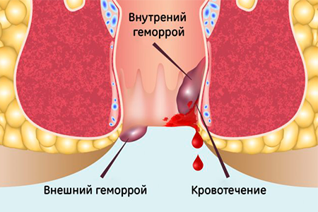 2534.png 2534.png