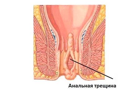 chchchpa.png chchchpa.png