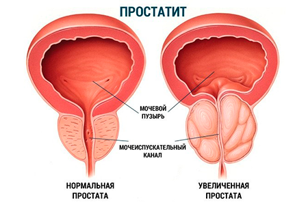 ro8.png ro8.png