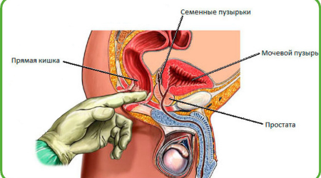 Dizajn-bez-nazvaniya.png Dizajn-bez-nazvaniya.png