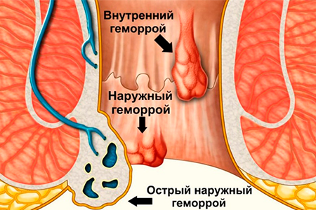9590.png 9590.png