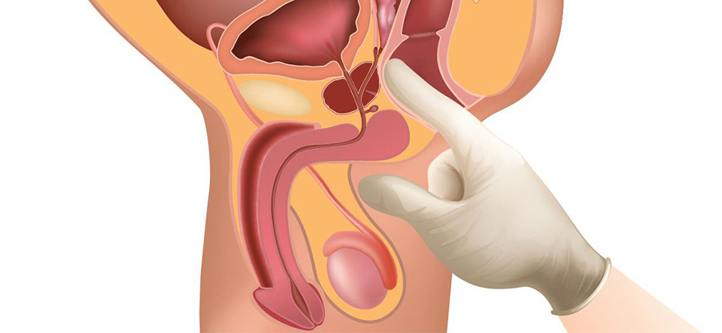 1595836118_massazh-prostaty.jpg 1595836118_massazh-prostaty.jpg